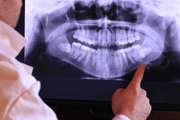 Best Broken or Cracked Tooth Emergency Dentist in Cypress, CA