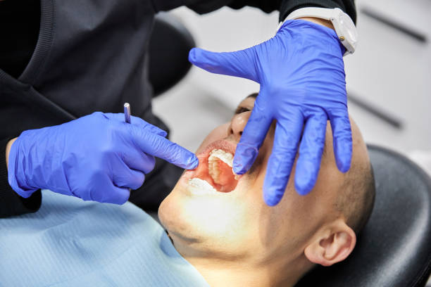 Best Emergency Dentist for Knocked-Out Tooth in Cypress, CA
